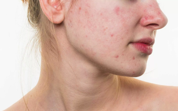 Add On - Extractions 5 mins Featured Image