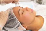 High Performance Microdermabrasion Featured Image