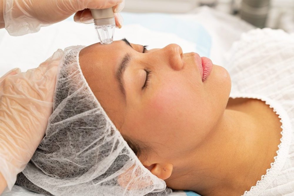 Classic Microdermabrasion Featured Image