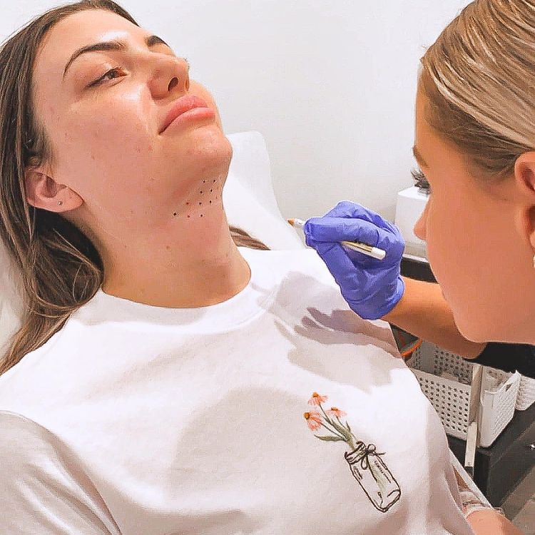 Nurse Leah carefully marking up her client before treating