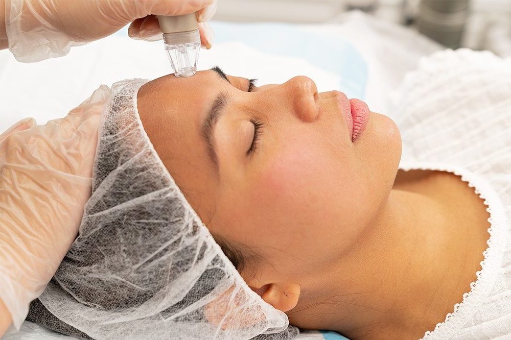 Classic Microdermabrasion Featured Image