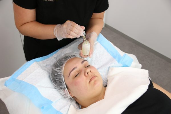 MediFacial - O2 Oxygen