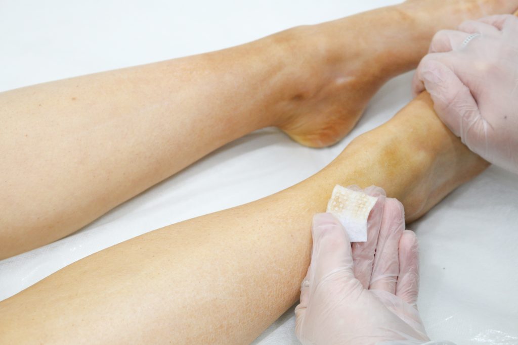 Laser hair removal session and removing fake tan