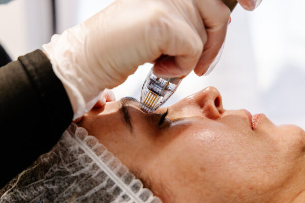 Add On Sylfirm X™ - Eye Area Featured Image