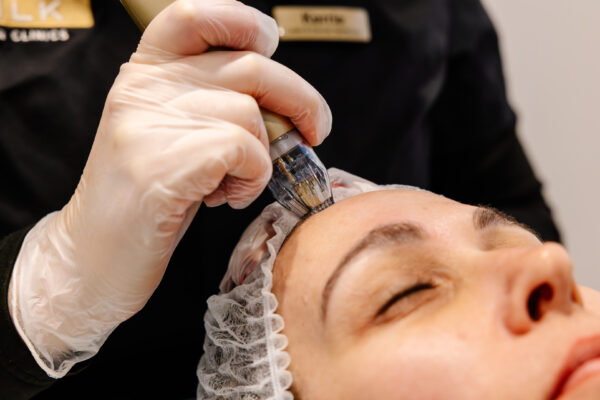 Add On Sylfirm X™ - Hands Featured Image